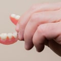 Types of Dentures and Bridges: Your Guide to Understanding Dental Treatments