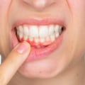 Flossing Tips for Optimal Oral Hygiene: A Comprehensive Guide for Pflugerville Texas Dentists