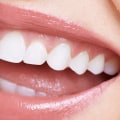 At-Home Whitening Options: Achieving a Brighter Smile in the Comfort of Your Own Home