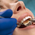 Post-treatment Care: How to Maintain Good Oral Health After Your Dental Visit