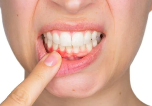 Flossing Tips for Optimal Oral Hygiene: A Comprehensive Guide for Pflugerville Texas Dentists