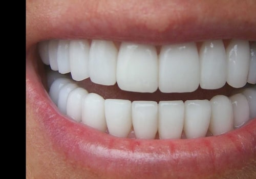 Maintaining White Teeth: Tips and Tricks for a Brighter Smile