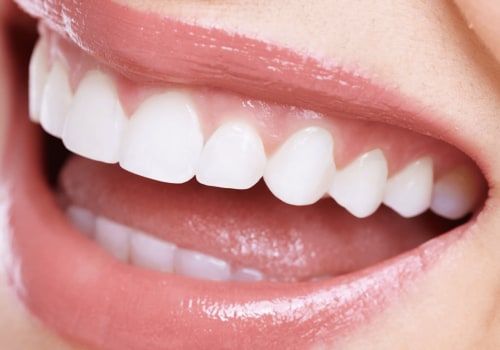 At-Home Whitening Options: Achieving a Brighter Smile in the Comfort of Your Own Home