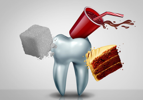 Understanding the Role of Sugar in Tooth Decay