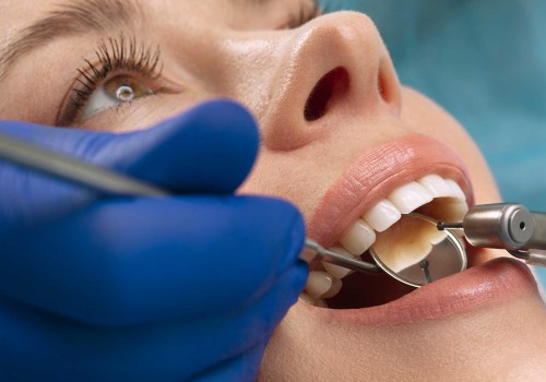 Post-treatment Care: How to Maintain Good Oral Health After Your Dental Visit