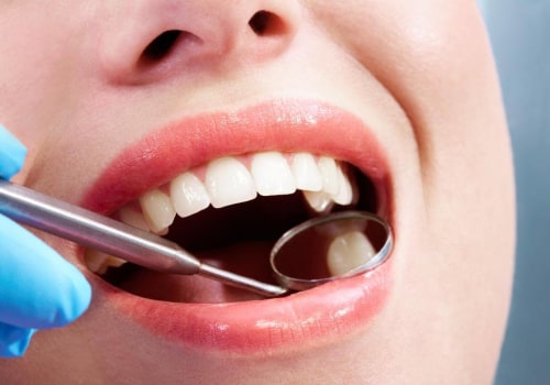 A Comprehensive Look at Different Types of Fillings for Pflugerville Texas Dentists